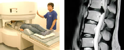 写真:設備「開放型MRI(AIRIS)」
